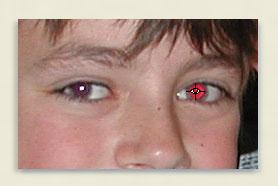 Red eye correction