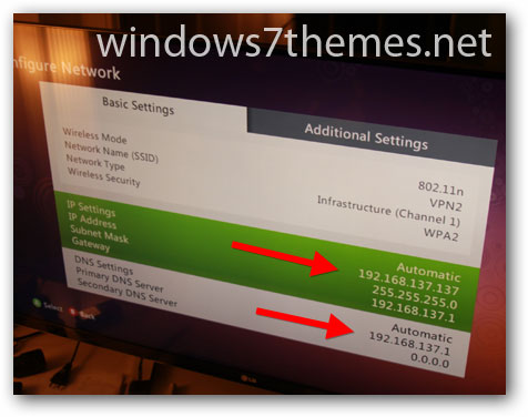 Xbox Settings For Vpn Connection